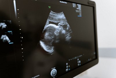 Все об УЗИ при беременности: 3D и 4D УЗИ